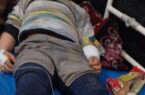 سگ ولگرد، ۵ نفر را در تبریز راهی بیمارستان کرد